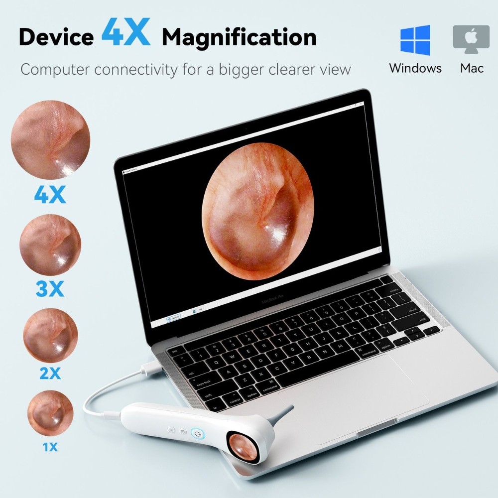 digitales Otoskop und Ohrreinigung für Kinder