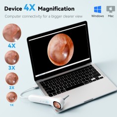 Otoscopie numérique et nettoyage des oreilles pour enfants