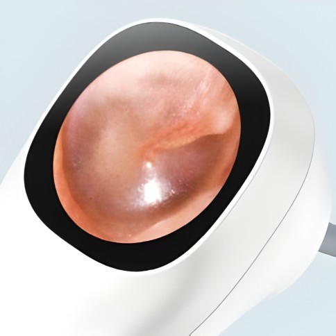 Otoscopie numérique et nettoyage des oreilles pour enfants